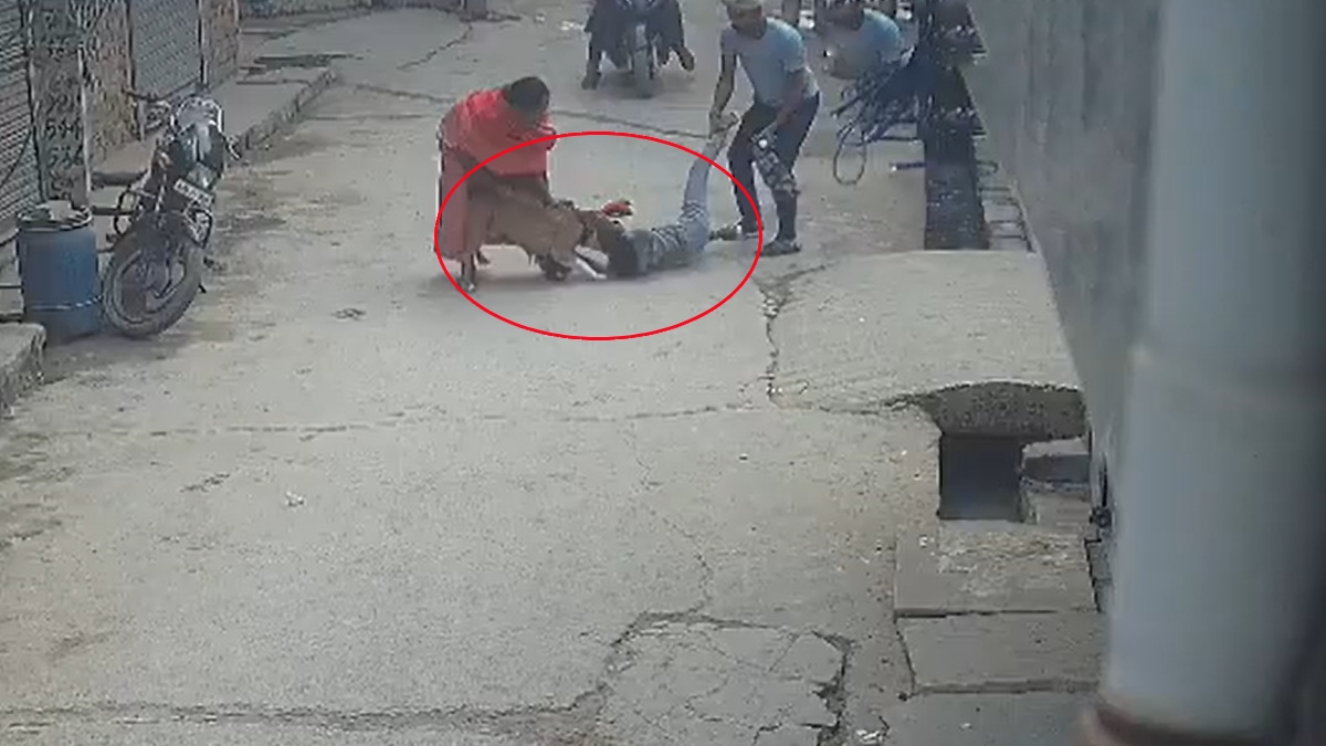 Video: Pitbull Savagely Attacks 6-Year-Old Boy, Bites Off His Ear in Delhi; Dog Owner Arrested