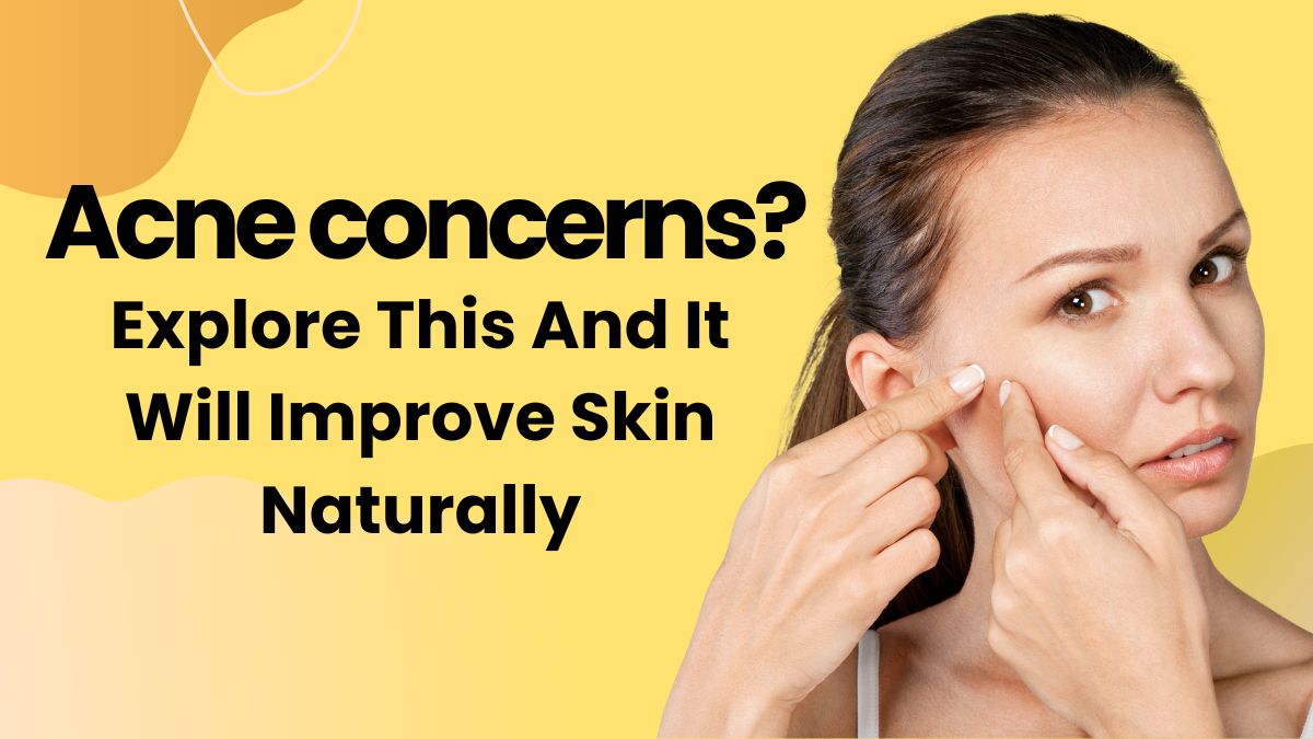 Acne concerns? Try This And It Will Improve Your Skin Naturally