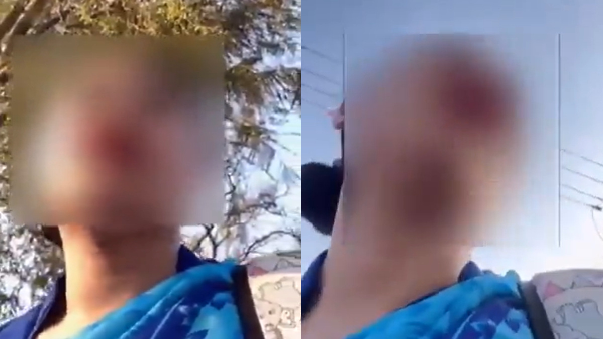 Bengaluru Shocker: Professional Chased by Naked Man in Car; Slam Bystander Apathy in Viral Video