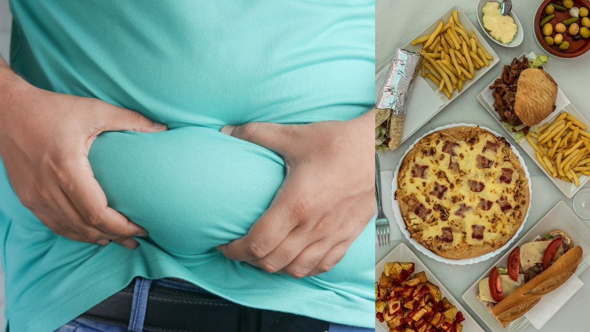 Obesity Rising at Alarming Rate in India