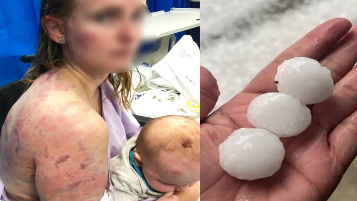 Heroic Mother Saves Baby from Tennis‑Ball Sized Hailstones in Australia Storm
