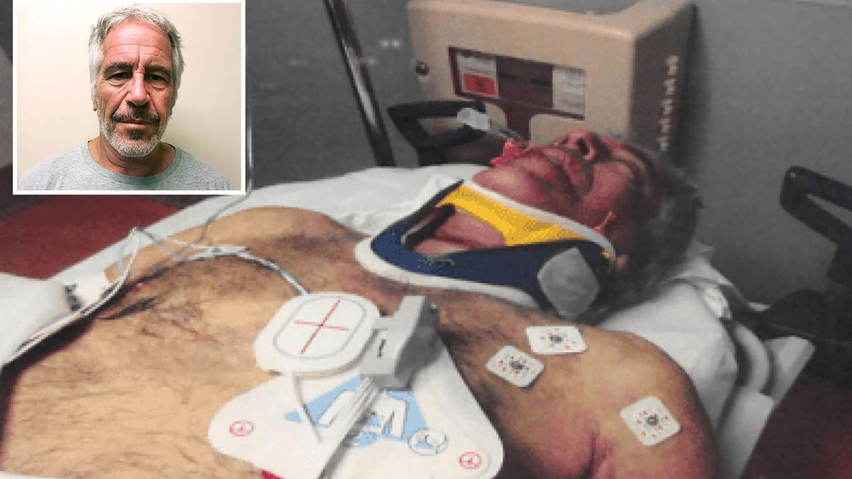 Never-Seen Epstein Photos Detail Resuscitation Efforts and Multiple Neck Fractures