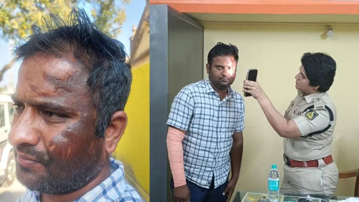 Jewellery Store Owner Arrested for Staging Acid Attack to Escape Debts