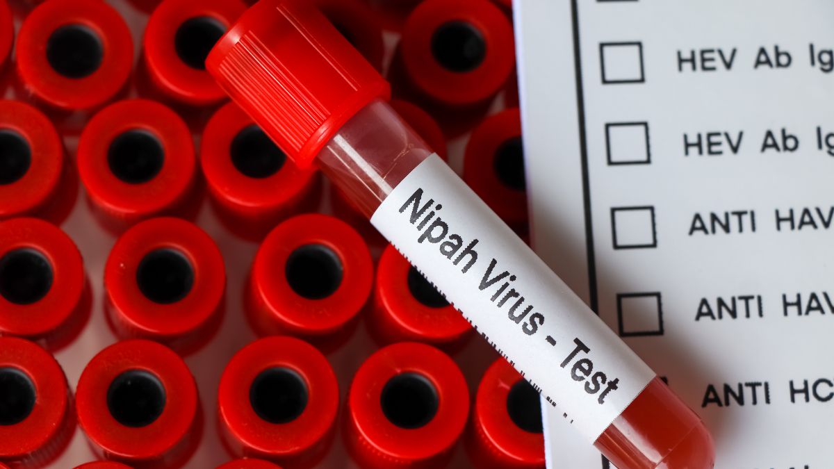 West Bengal on High Alert: 25-Year-Old Nurse Reports State’s First Nipah Virus Fatality