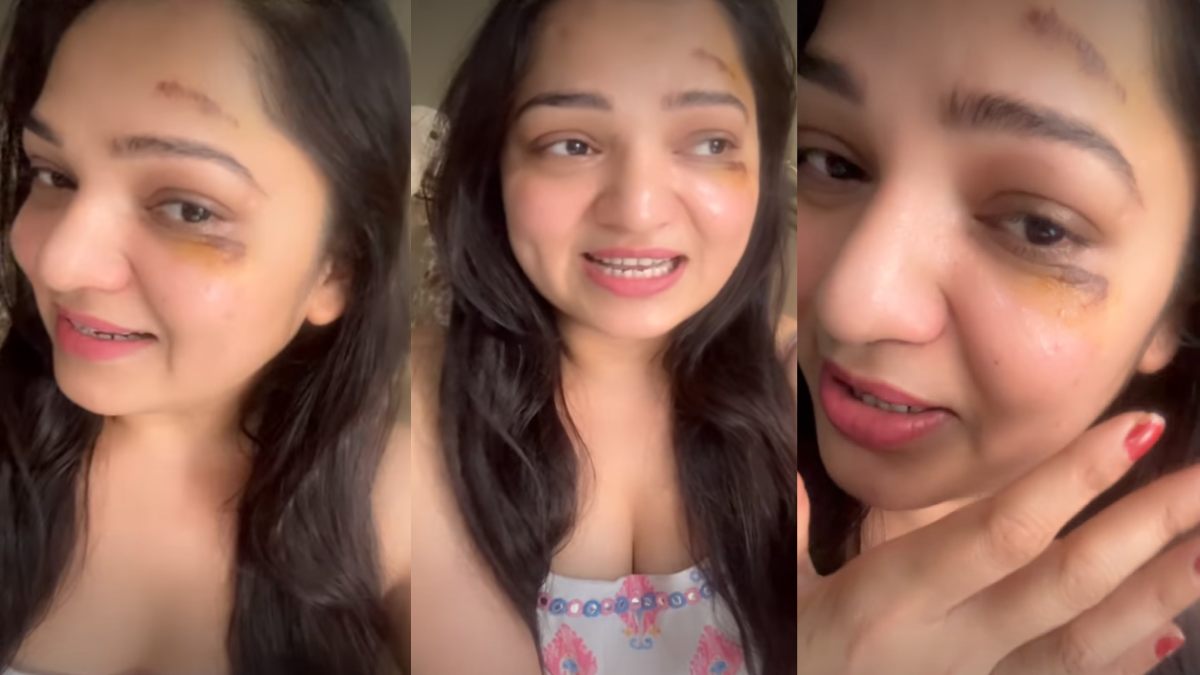 Bigg Boss Telugu Fame Ashwini Sri Injured After Fall While Walking Dog