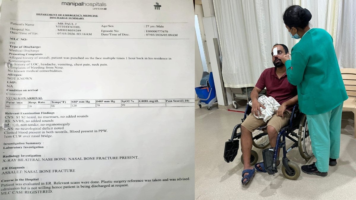 Bengaluru Delivery Agent Assaults Customer in Koramangala, Victim Suffers Broken Nose