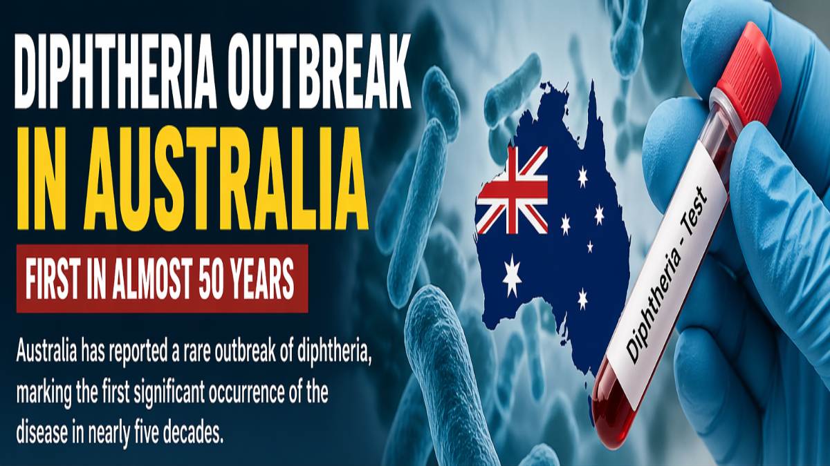 Australia Reports First Diphtheria Outbreak in Nearly 50 Years: Symptoms, Prevention and Treatment