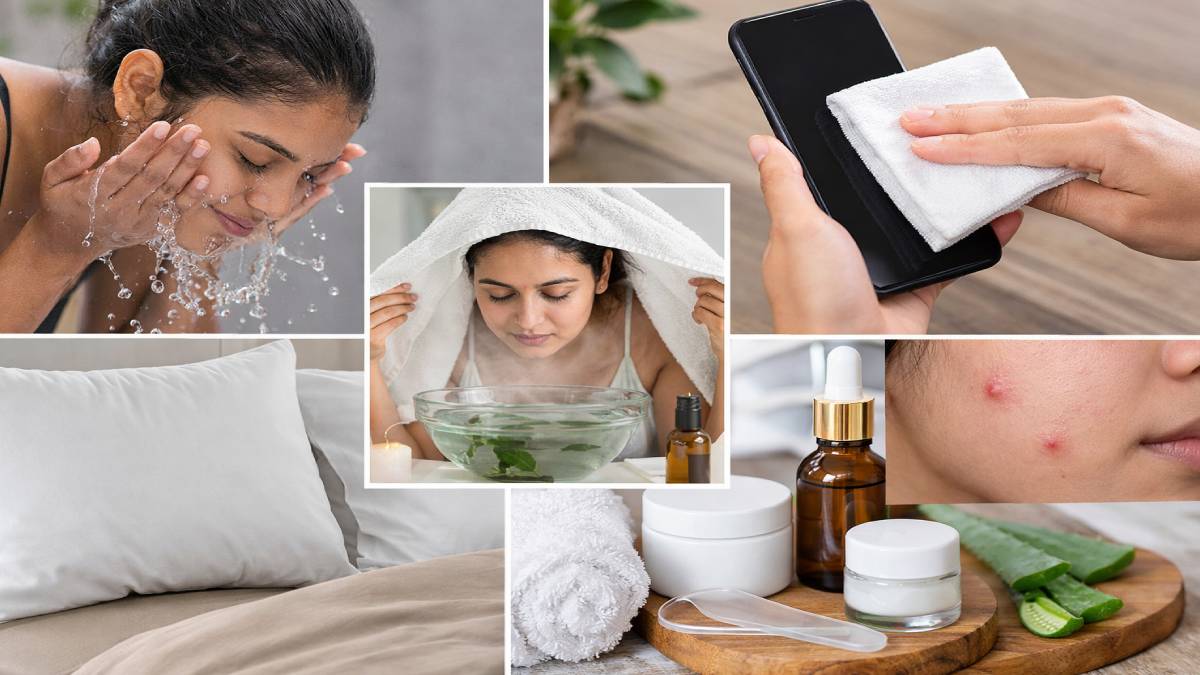 ಬೇಸಿಗೆಯಲ್ಲಿ ಮೊಡವೆ ಕಾಟವೇ? ಮುಖದ ಅಂದ ಕಾಪಾಡಿಕೊಳ್ಳಲು ಇಲ್ಲಿವೆ 9 ಸಿಂಪಲ್ ಟಿಪ್ಸ್‌!! ಇವತ್ತಿನಿಂದಲೇ ಫಾಲೋ ಮಾಡಿ;