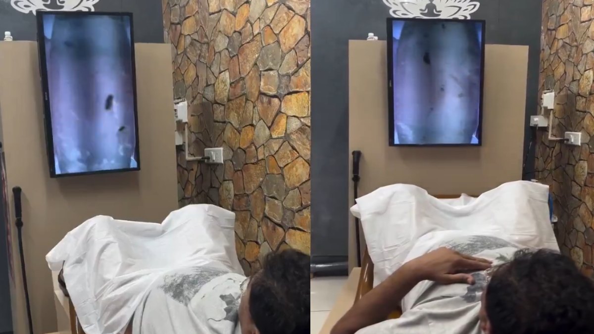 Severe Constipation and Intestinal Parasites: Symptoms, Causes, and Medical Treatment