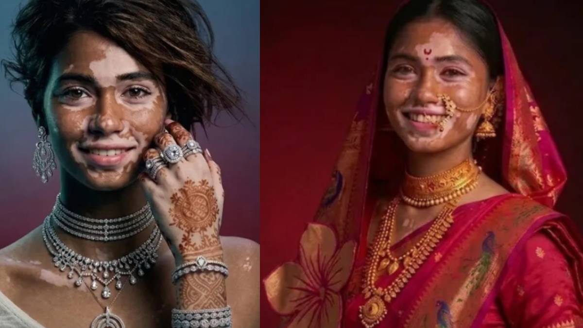 ಸೌಂದರ್ಯ ಅಂದ್ರೆ ಬಣ್ಣವಲ್ಲ, ಅದು ಆತ್ಮವಿಶ್ವಾಸ - ಮಾರ್ಕೆಟಿಂಗ್ ಲೋಕದಲ್ಲಿ ಹೊಸ ಕ್ರಾಂತಿ; ಎಲ್ಲಿ ಗೊತ್ತಾ?