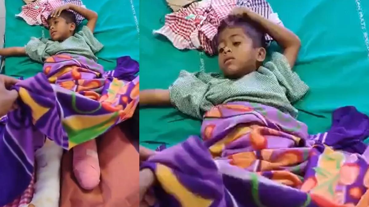 Tragedy at Sammakka Temple: ₹251 Crore Project Collapse Leaves Child Amputated