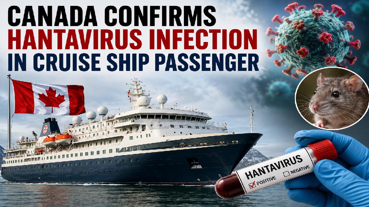 Canada Confirms Hantavirus Case | Photo Credit: AI Image