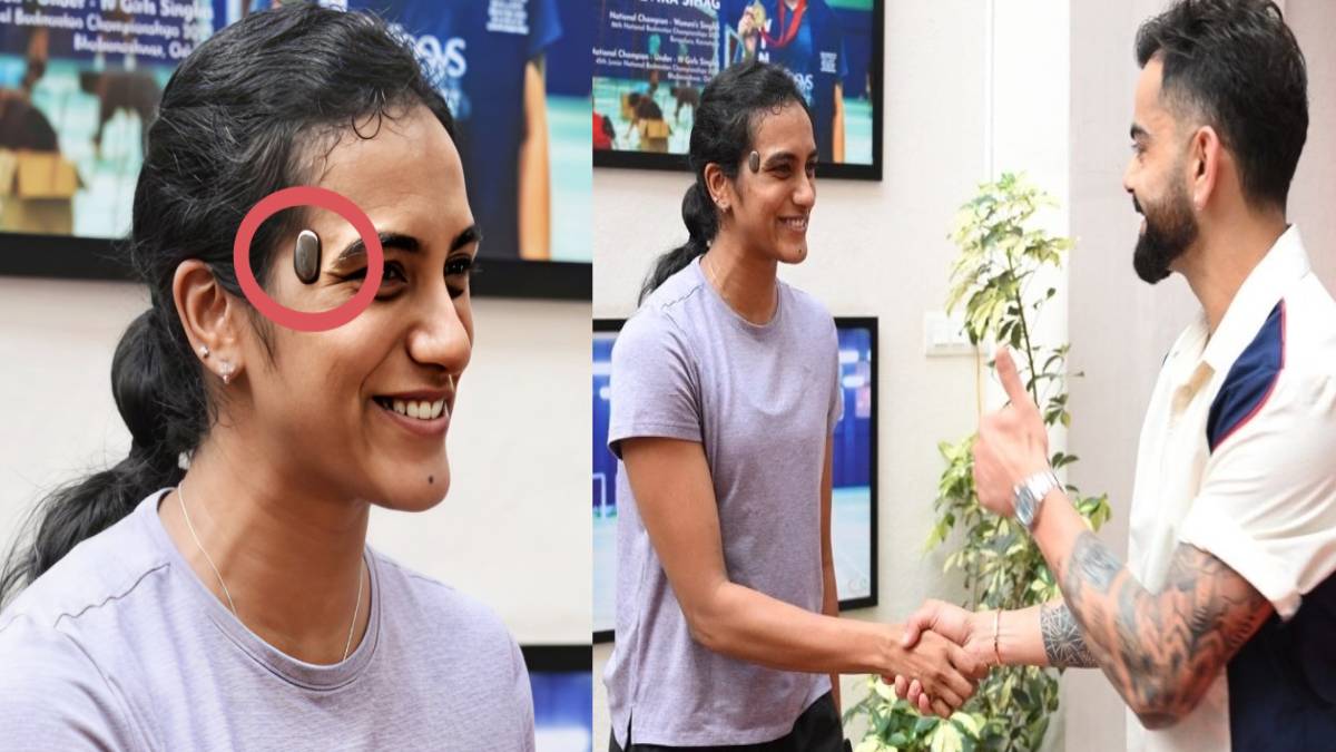 ಕೊಹ್ಲಿಯನ್ನು ಭೇಟಿಯಾದ ಪಿ.ವಿ. ಸಿಂಧು - ಬ್ಯಾಡ್ಮಿಂಟನ್ ತಾರೆಯ ಹಣೆ ಮೇಲಿದ್ದ ಆ 'ವಿಚಿತ್ರ ಸಾಧನ' ಏನು ಗೊತ್ತಾ?