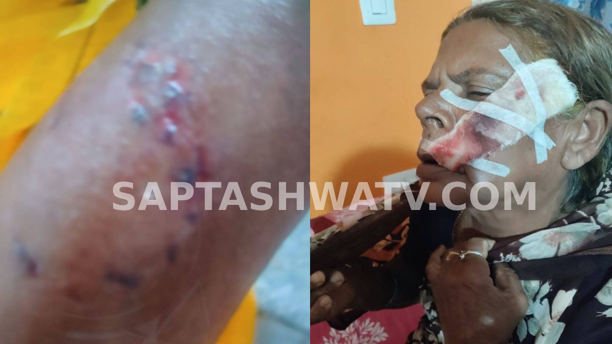 Mandya Stray Dog Attack: Elderly Woman Suffers Serious Injuries, Residents Demand Action
