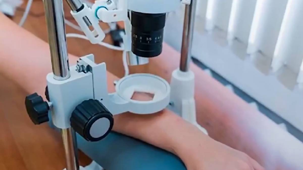 Russian Scientists Develop AI-Ready Microscope That Detects Hidden Skin Damage