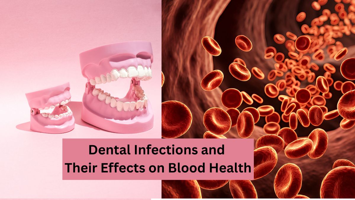 Dental Infections and Their Effects on Blood Health