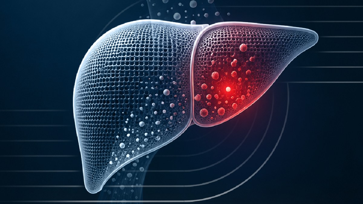 Hepatitis: The Silent Liver Disease That Can Be Prevented and Treated