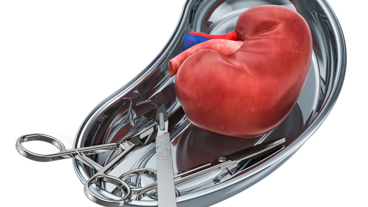 Laparoscopic Kidney Donation: A Safer, Less Invasive Way to Save Lives