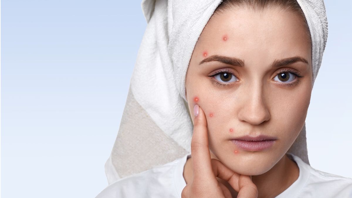 How to Care for Sensitive Skin: 5 Essential Tips for Healthy, Calm Skin