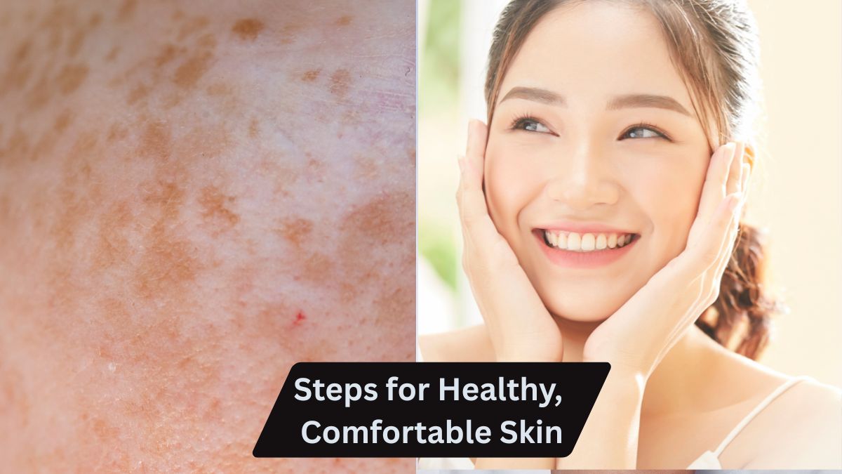 How to Manage Skin Allergies: 3 Essential Steps for Healthy, Comfortable Skin