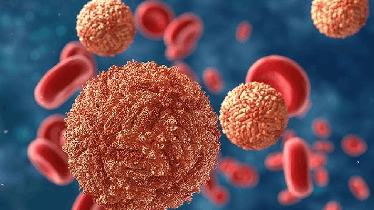 Leukaemia Lancet | Photo Credit: https://medicine.smhs.gwu.edu/infectious-diseases