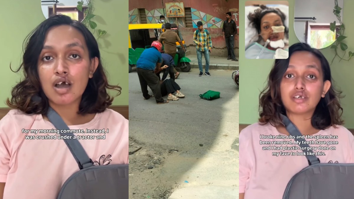 Bengaluru Woman Suffers Severe Injuries in Rapido Bike Taxi Accident, Family Alleges Lack of Support From Company