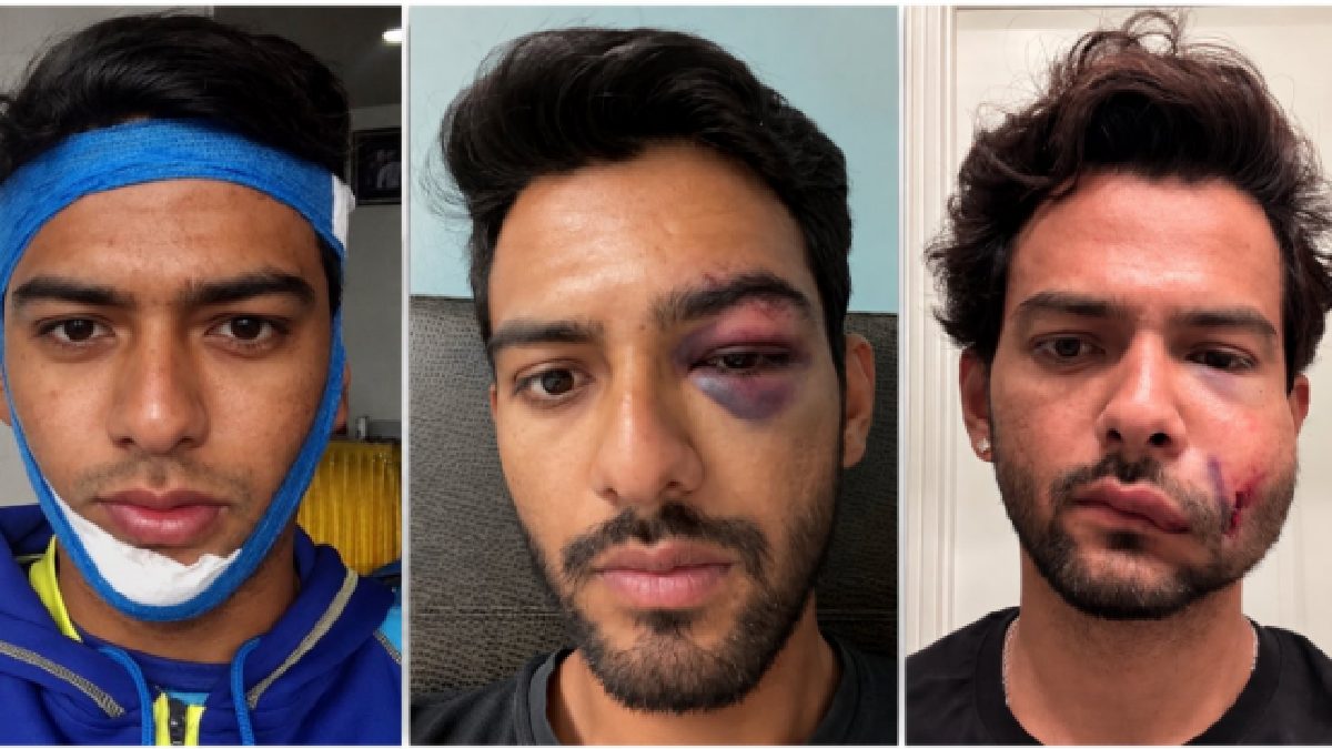 Former India Star Suffers Horror Injury A Day After Scoring Century, Shares Update