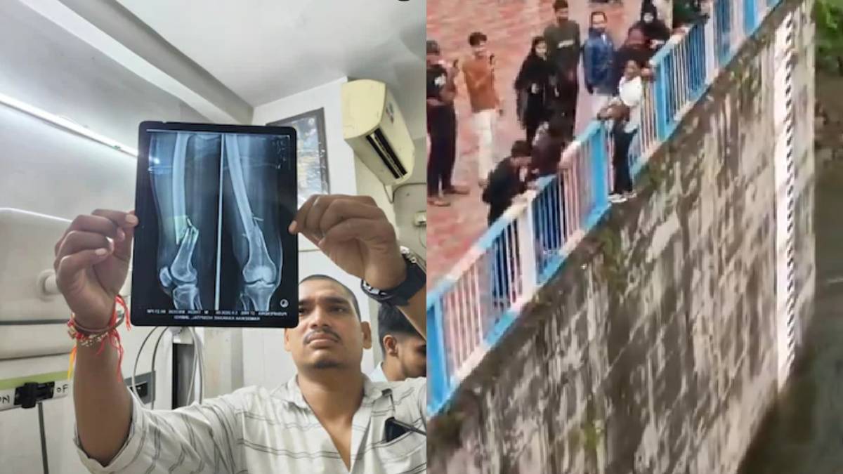 Jhansi Reel Stunt Turns Dangerous: 30-Foot Jump Into Pahuj Dam Leaves Man With Both Legs Fractured