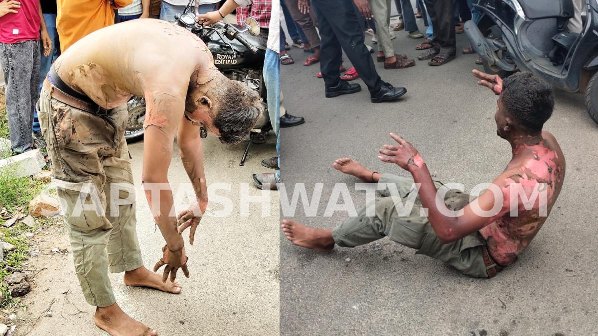 Mysuru: One-Sided Lover Sets Himself on Fire After Allegedly Harassing Engineering Student