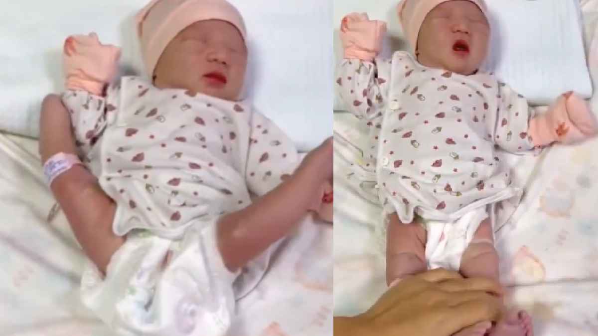 Newborn with unusually positioned lower limbs | Photo Credit: https://x.com/drabdulhameed07