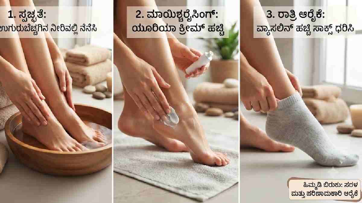 ಕಾಲಿನ ಹಿಮ್ಮಡಿ ಒಣಗಿ ಬಿರುಕು ಬಿಟ್ಟಿದೆಯಾ, ರಾತ್ರಿ ಈ ರೀತಿ ಆರೈಕೆ ಮಾಡಿ!!